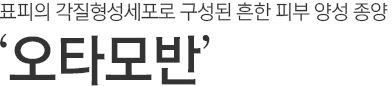 표피의 각질형성세포로 구성된 흔한 피부 양성 종양. 오타모반.